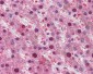 RPS6KB1 / P70S6K / S6K Antibody (C-Terminus)
